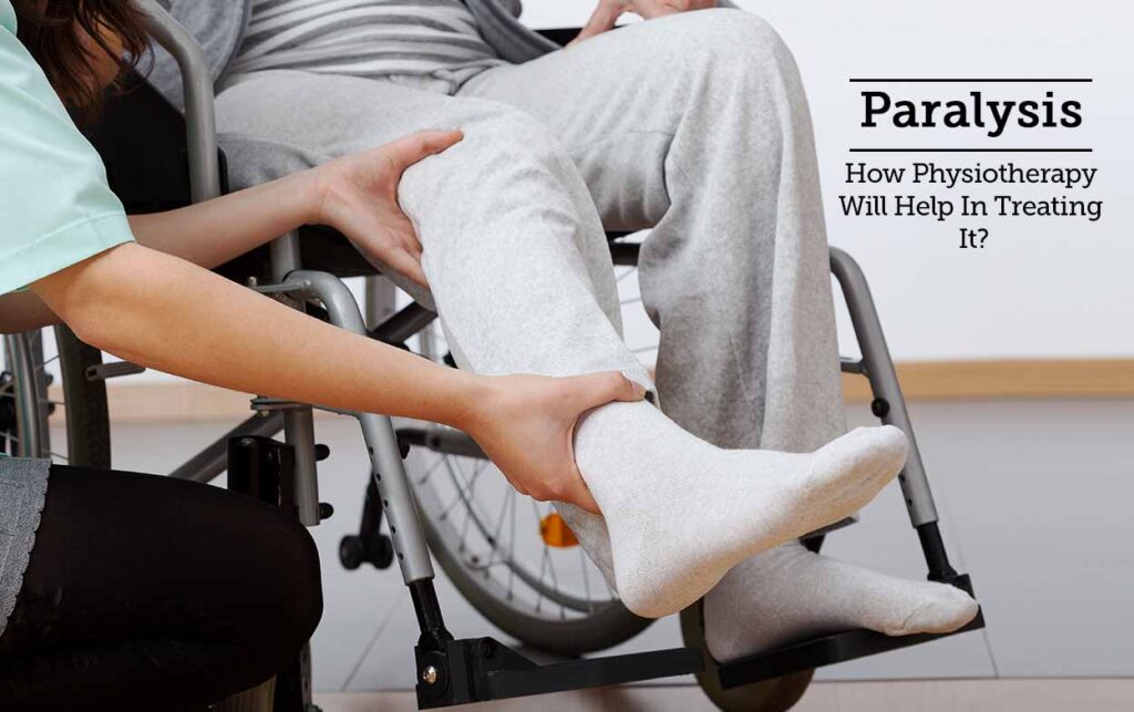 فیزیوتراپی فلج در منزل 